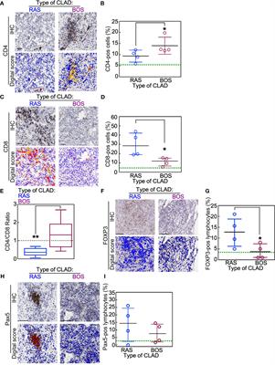 Immune Checkpoints Expression in Chronic Lung Allograft Rejection